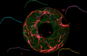 Ring-shaped neuronal networks: a platform to study persistent activity